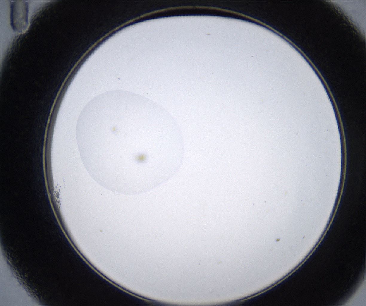 folderID215_plateID2215_batchID10049_wellNum11_profileID1_d2_r150732_ef.jpg