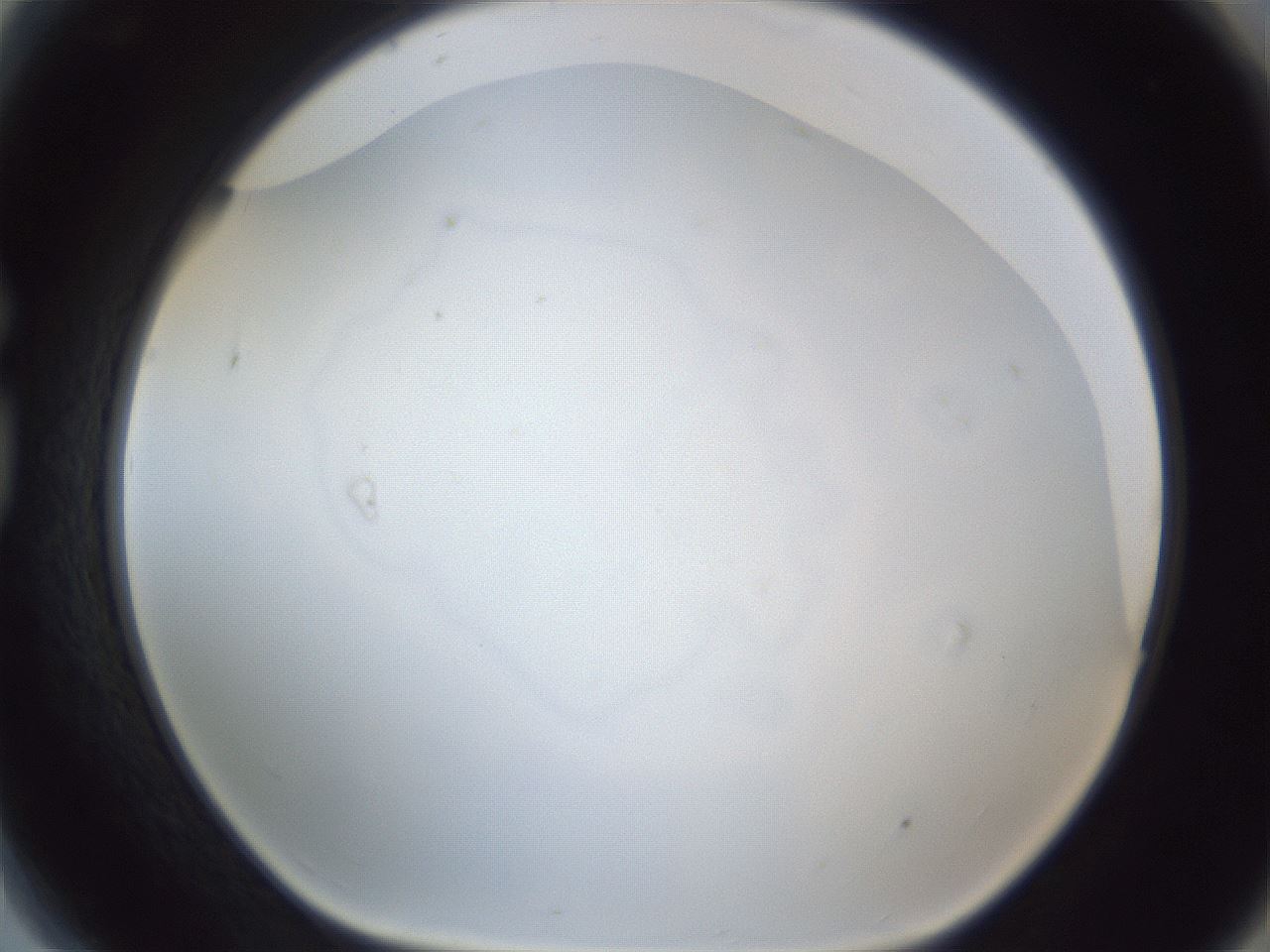 folderID216_plateID1216_batchID3656_wellNum81_profileID1_d1_r68256_ef.jpg