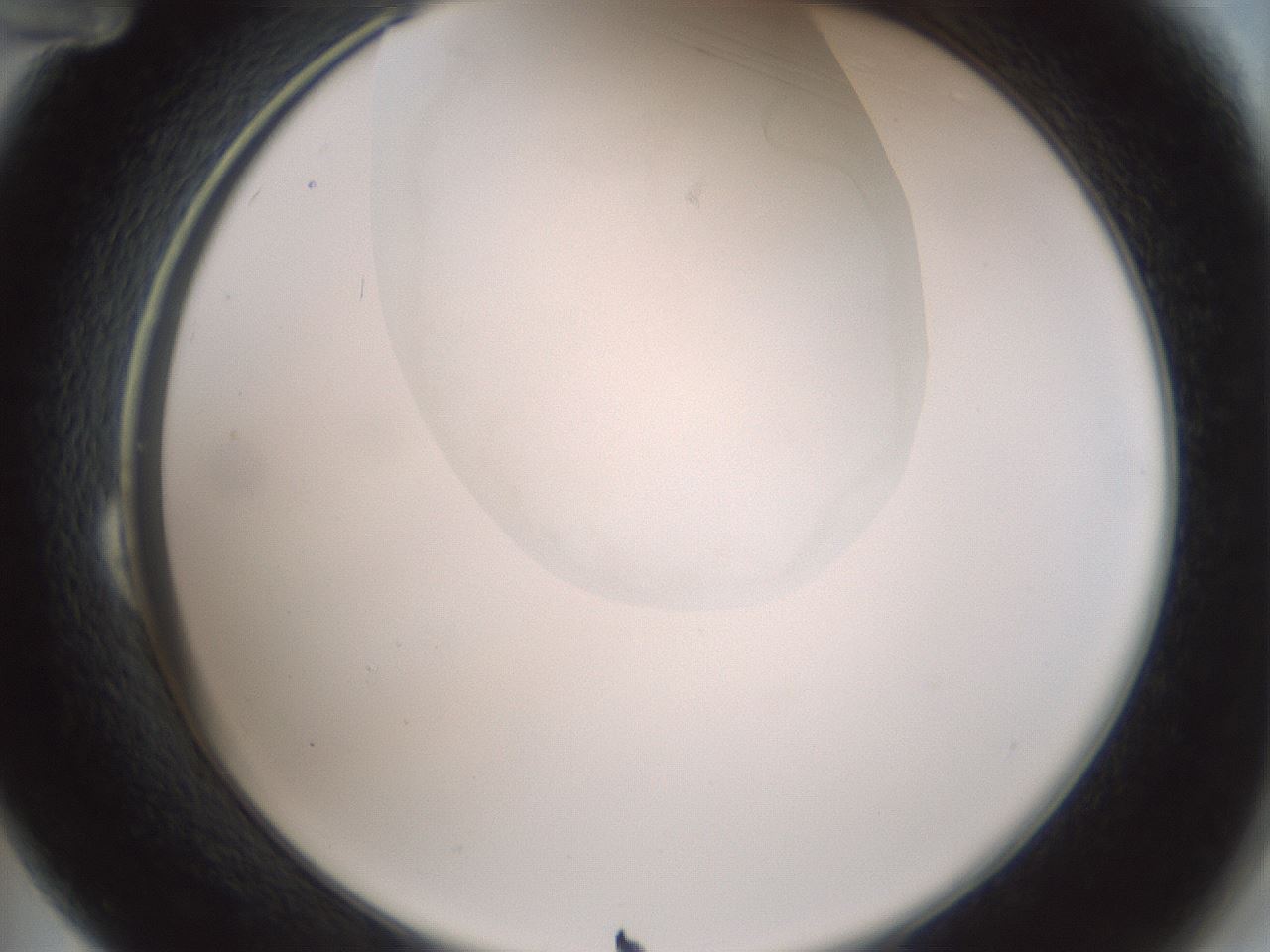 folderID230_plateID1230_batchID3779_wellNum24_profileID1_d2_r71673_ef.jpg