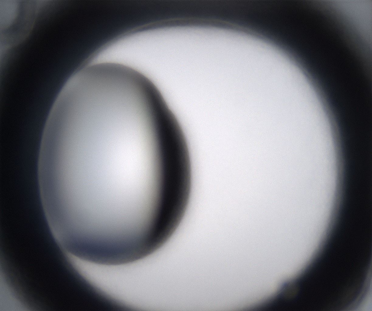 folderID230_plateID2230_batchID10094_wellNum82_profileID1_d2_r153278_ef.jpg