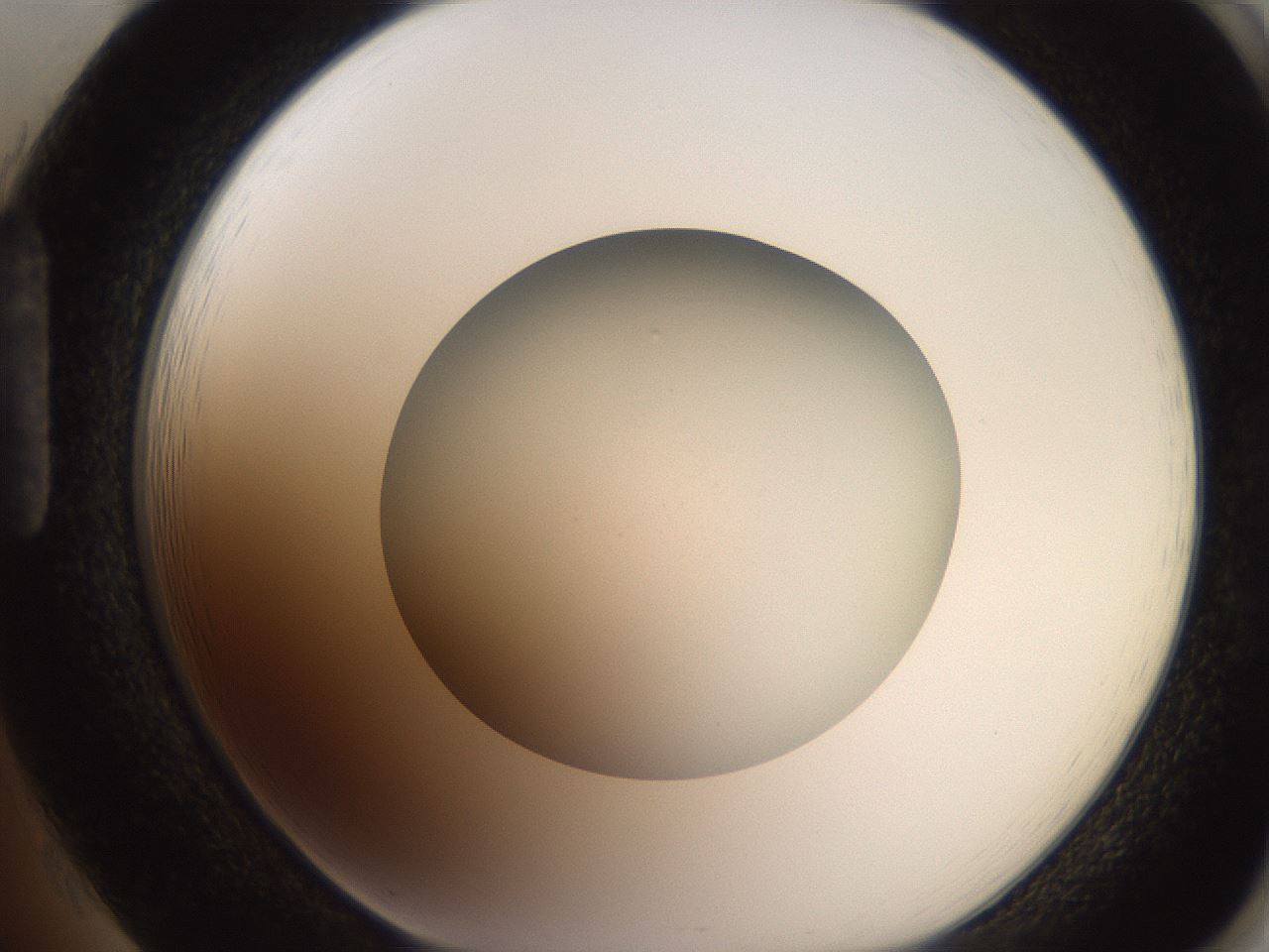 folderID233_plateID2233_batchID10121_wellNum85_profileID1_d1_r154351_ef.jpg