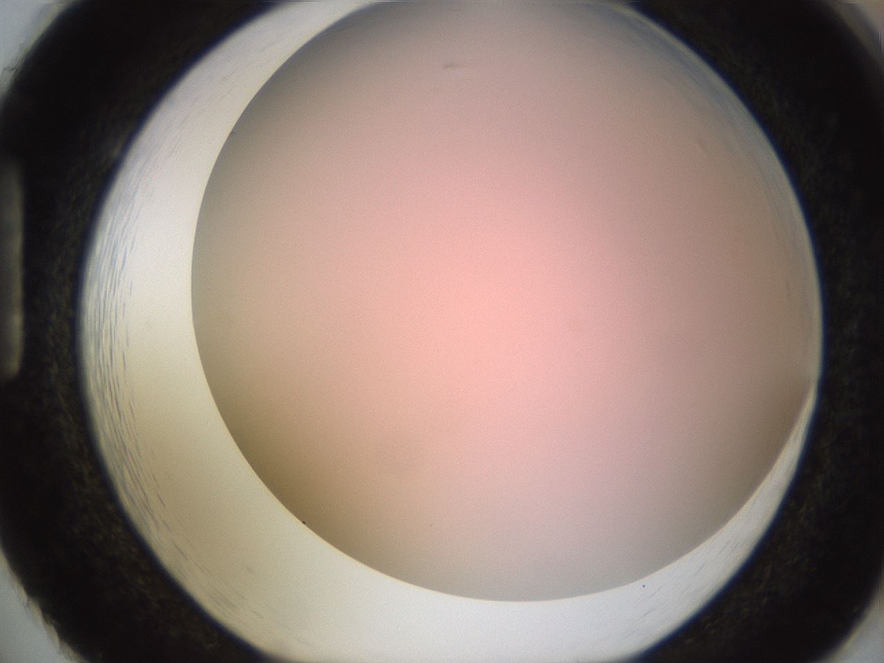 folderID241_plateID1241_batchID3808_wellNum86_profileID1_d1_r72311_ef.jpg