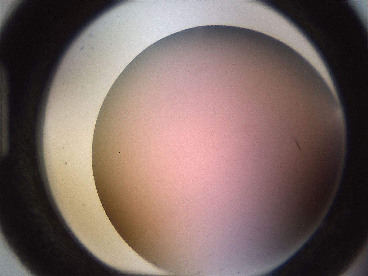 folderID241_plateID1241_batchID3808_wellNum92_profileID1_d1_r72317_ef.jpg