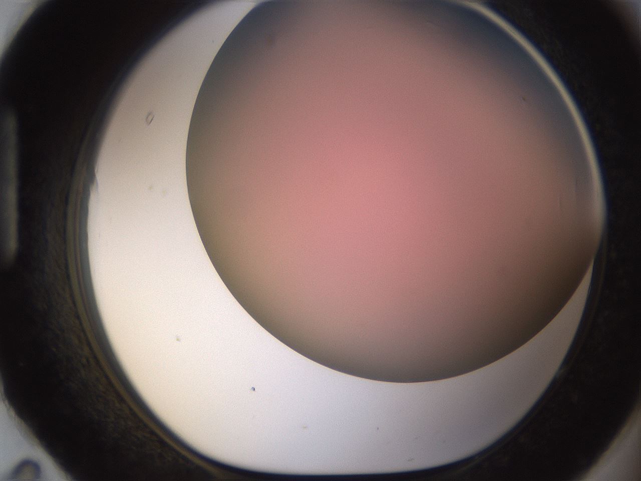 folderID241_plateID1241_batchID3808_wellNum95_profileID1_d1_r72320_ef.jpg