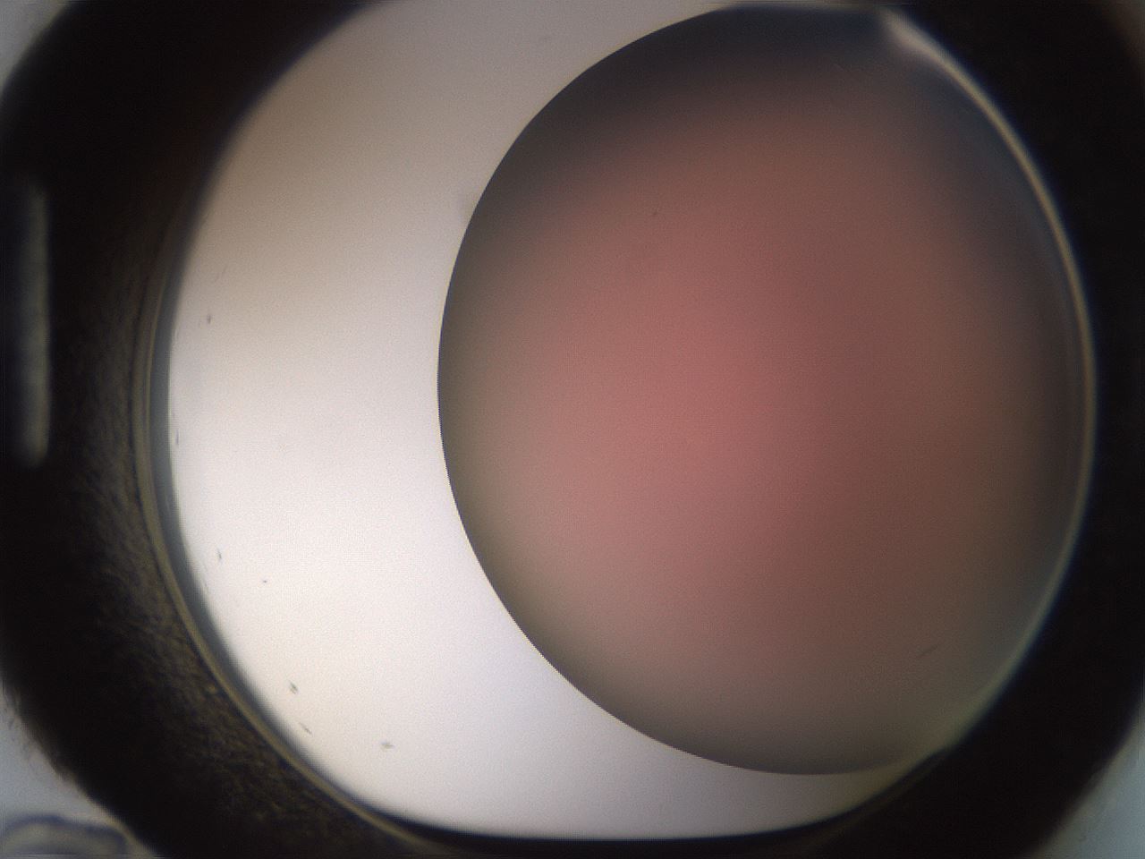 folderID241_plateID1241_batchID3808_wellNum96_profileID1_d1_r72321_ef.jpg