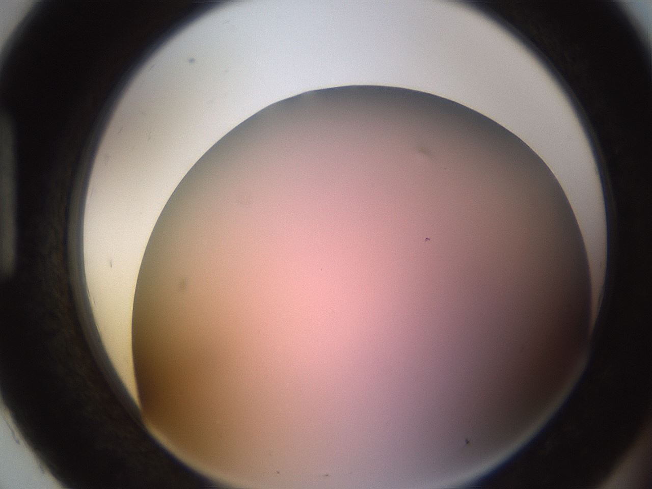 folderID241_plateID1241_batchID3808_wellNum93_profileID1_d1_r72318_ef.jpg