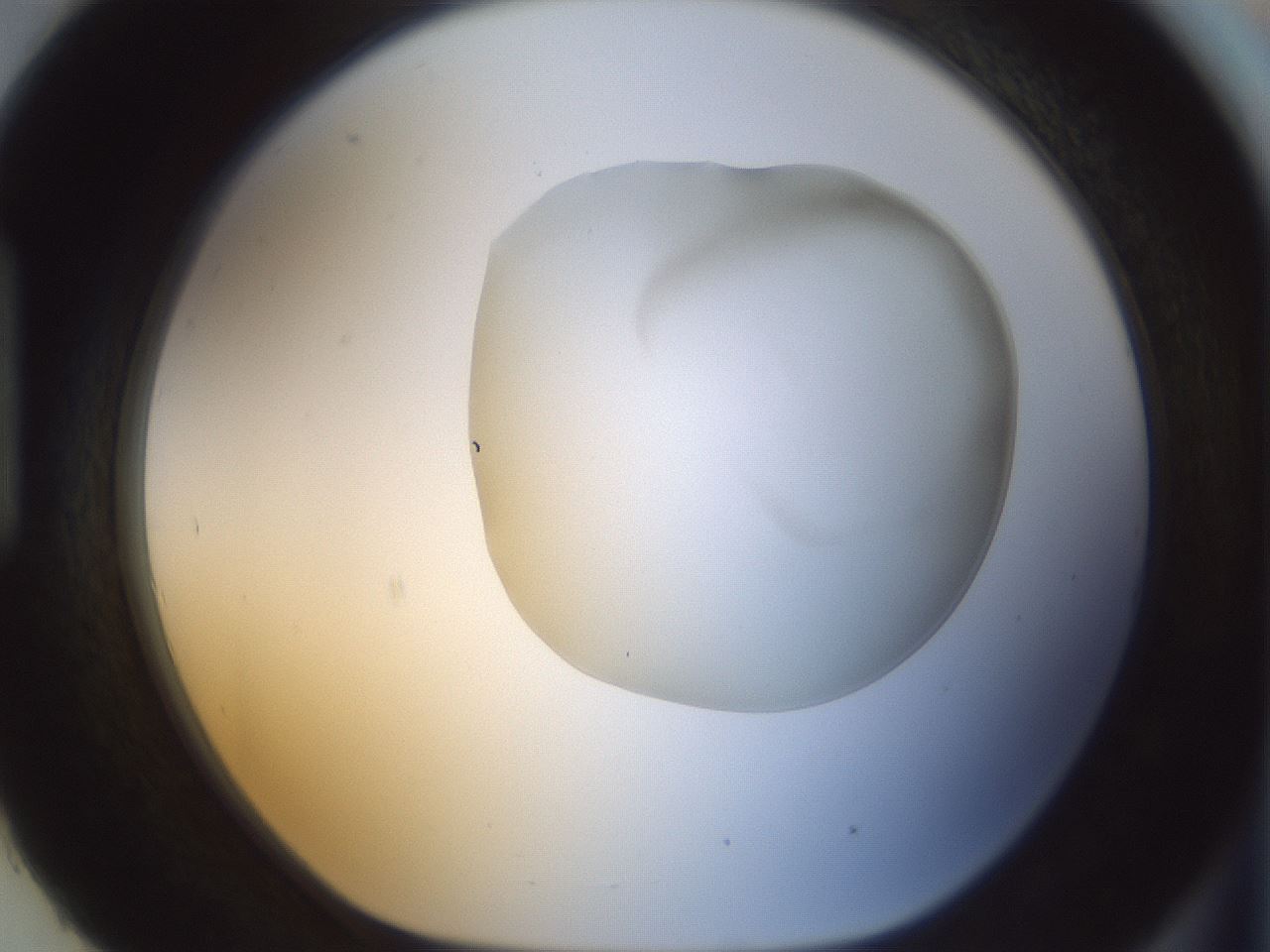 folderID156_plateID1156_batchID3128_wellNum93_profileID1_d1_r63767_ef.jpg