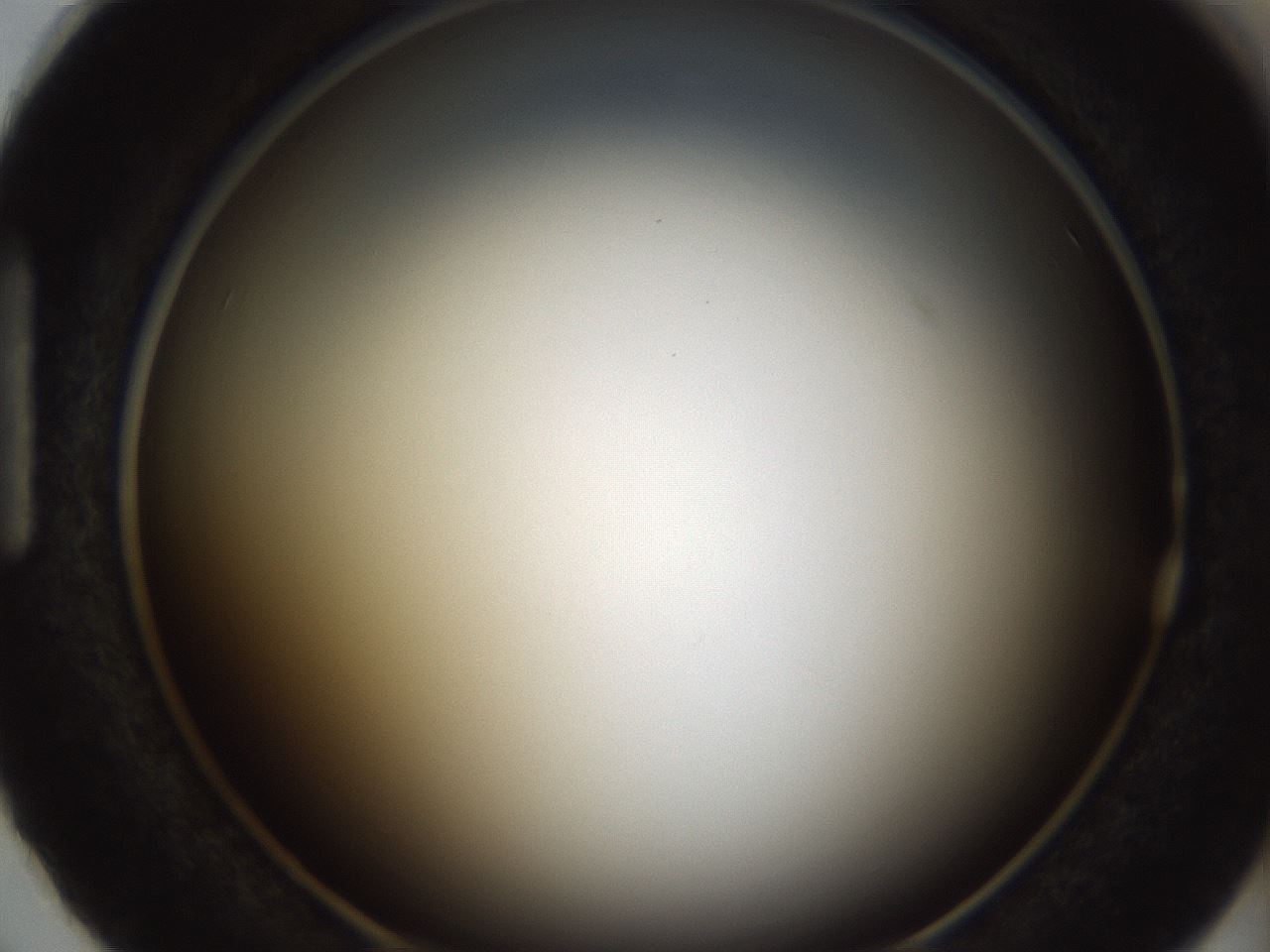 folderID157_plateID1157_batchID3210_wellNum87_profileID1_d1_r63563_ef.jpg