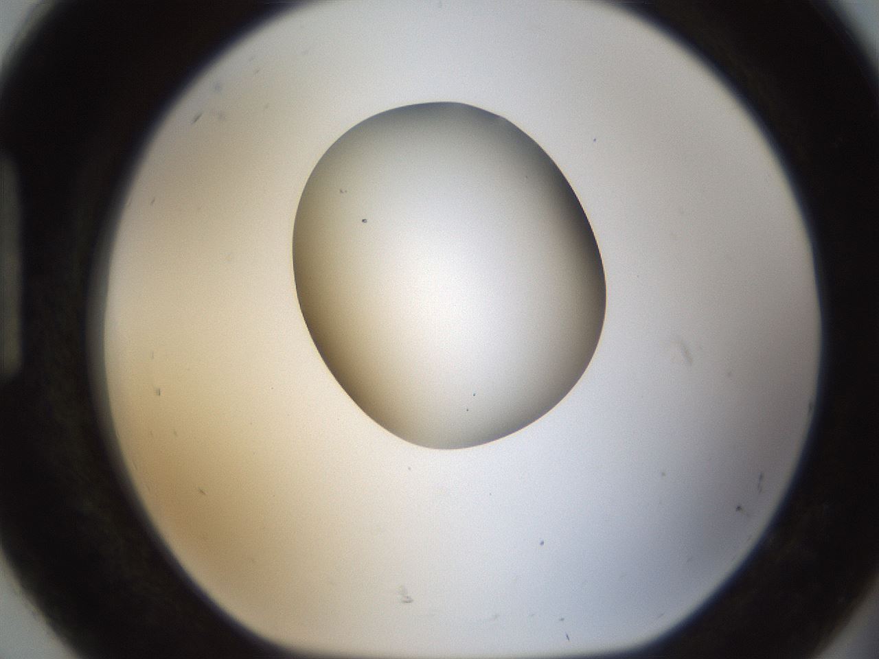 folderID157_plateID1157_batchID3210_wellNum92_profileID1_d1_r63573_ef.jpg