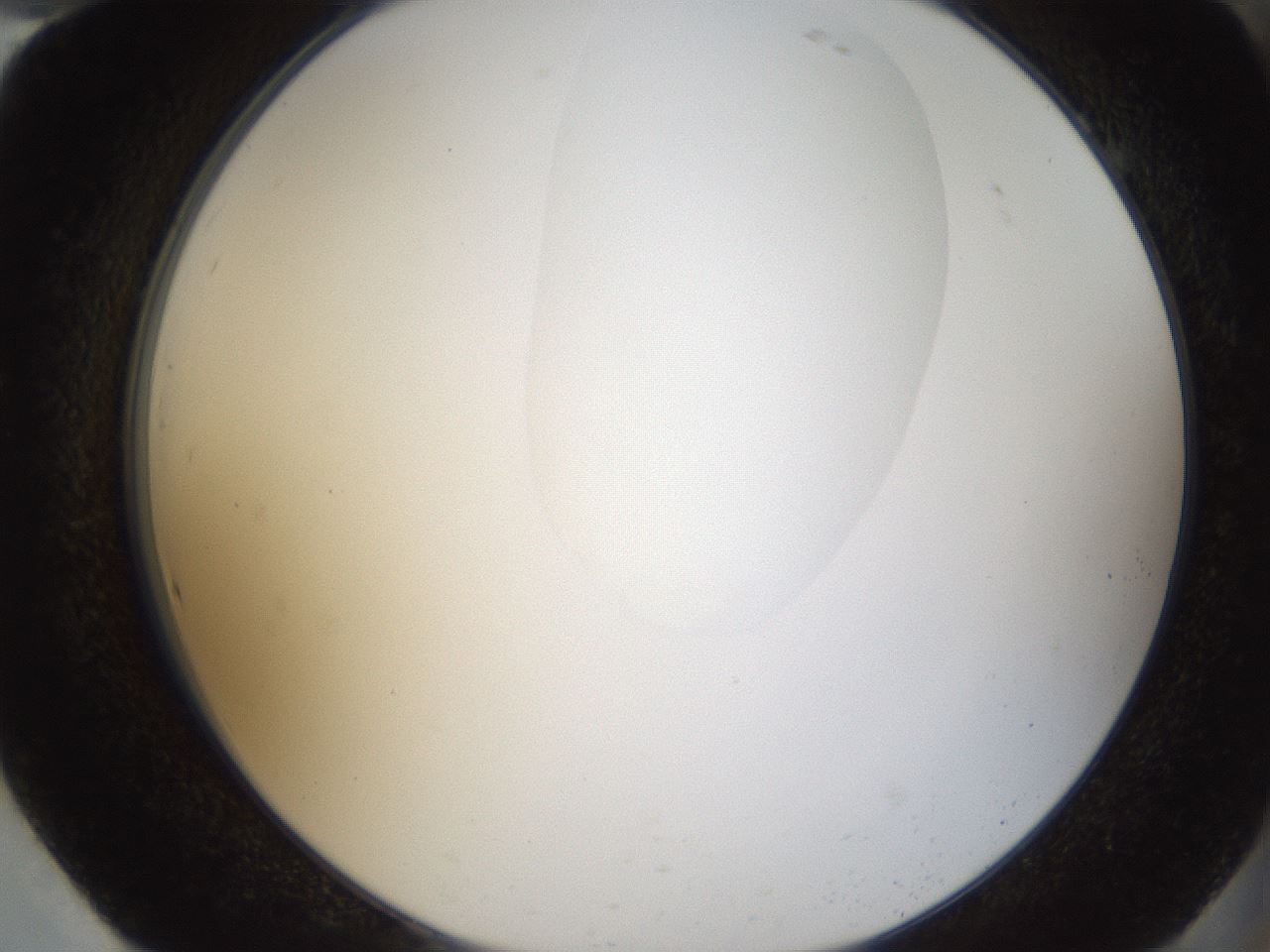 folderID157_plateID1157_batchID3210_wellNum94_profileID1_d2_r63578_ef.jpg