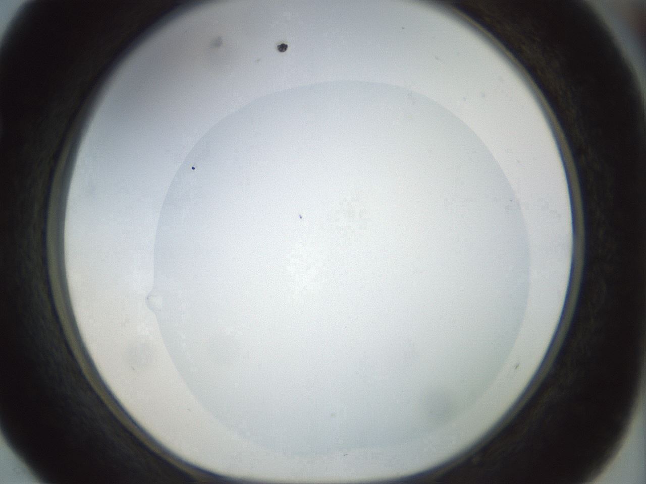 folderID15_plateID1015_batchID1886_wellNum52_profileID1_d1_r43031_ef.jpg