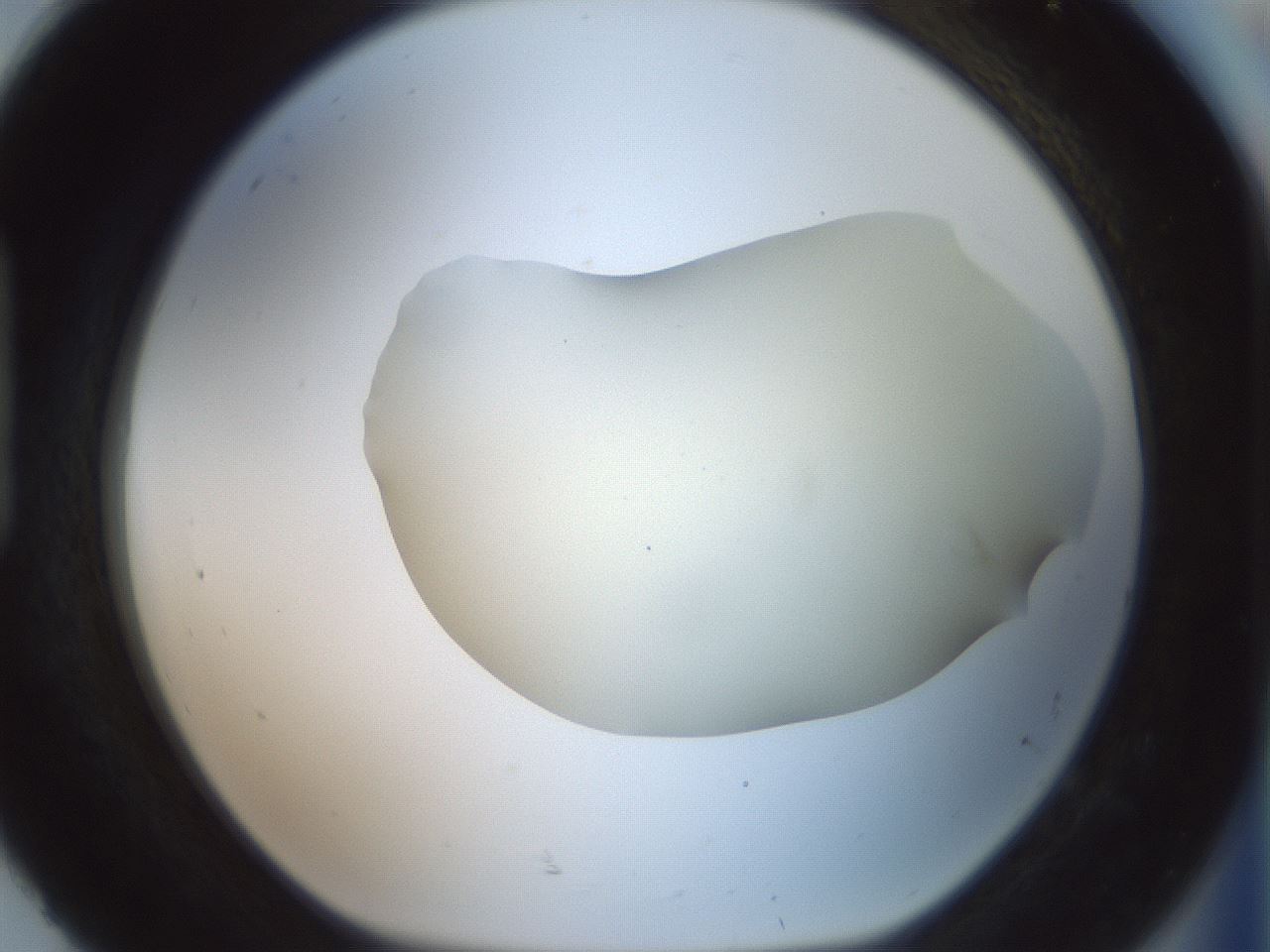folderID15_plateID2015_batchID8963_wellNum92_profileID1_d1_r135648_ef.jpg