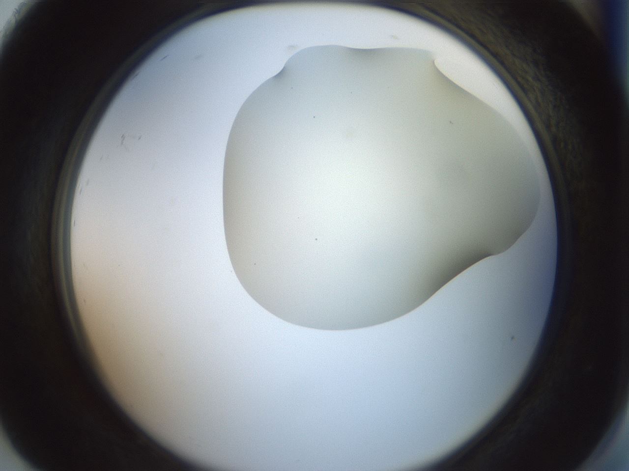 folderID15_plateID2015_batchID8963_wellNum92_profileID1_d2_r135649_ef.jpg