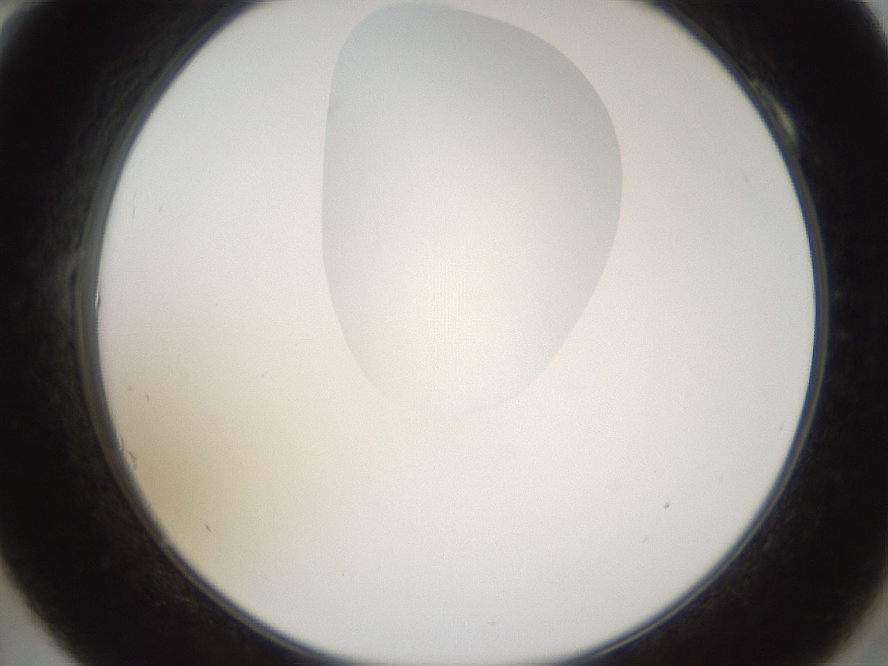 folderID160_plateID1160_batchID3204_wellNum10_profileID1_d2_r62258_ef.jpg