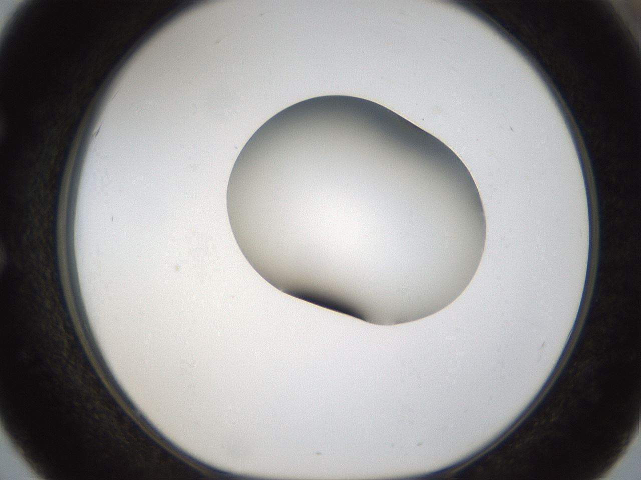 folderID160_plateID1160_batchID3204_wellNum51_profileID1_d1_r62339_ef.jpg