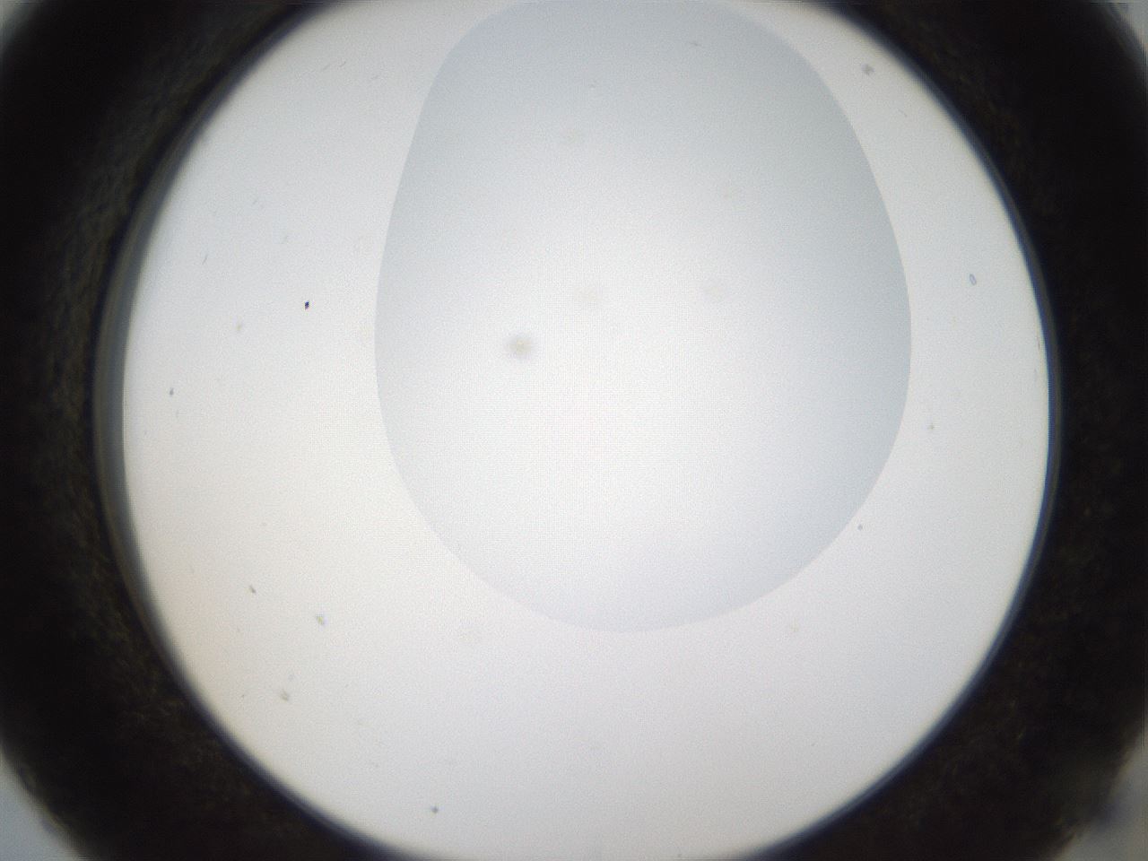 folderID160_plateID1160_batchID3204_wellNum5_profileID1_d2_r62248_ef.jpg