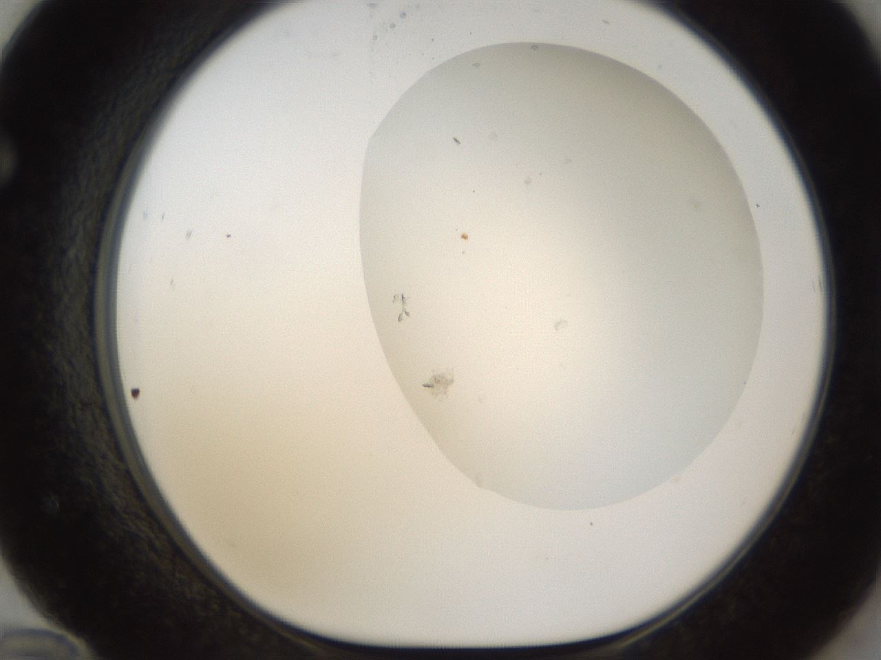 folderID160_plateID1160_batchID3204_wellNum72_profileID1_d1_r62381_ef.jpg