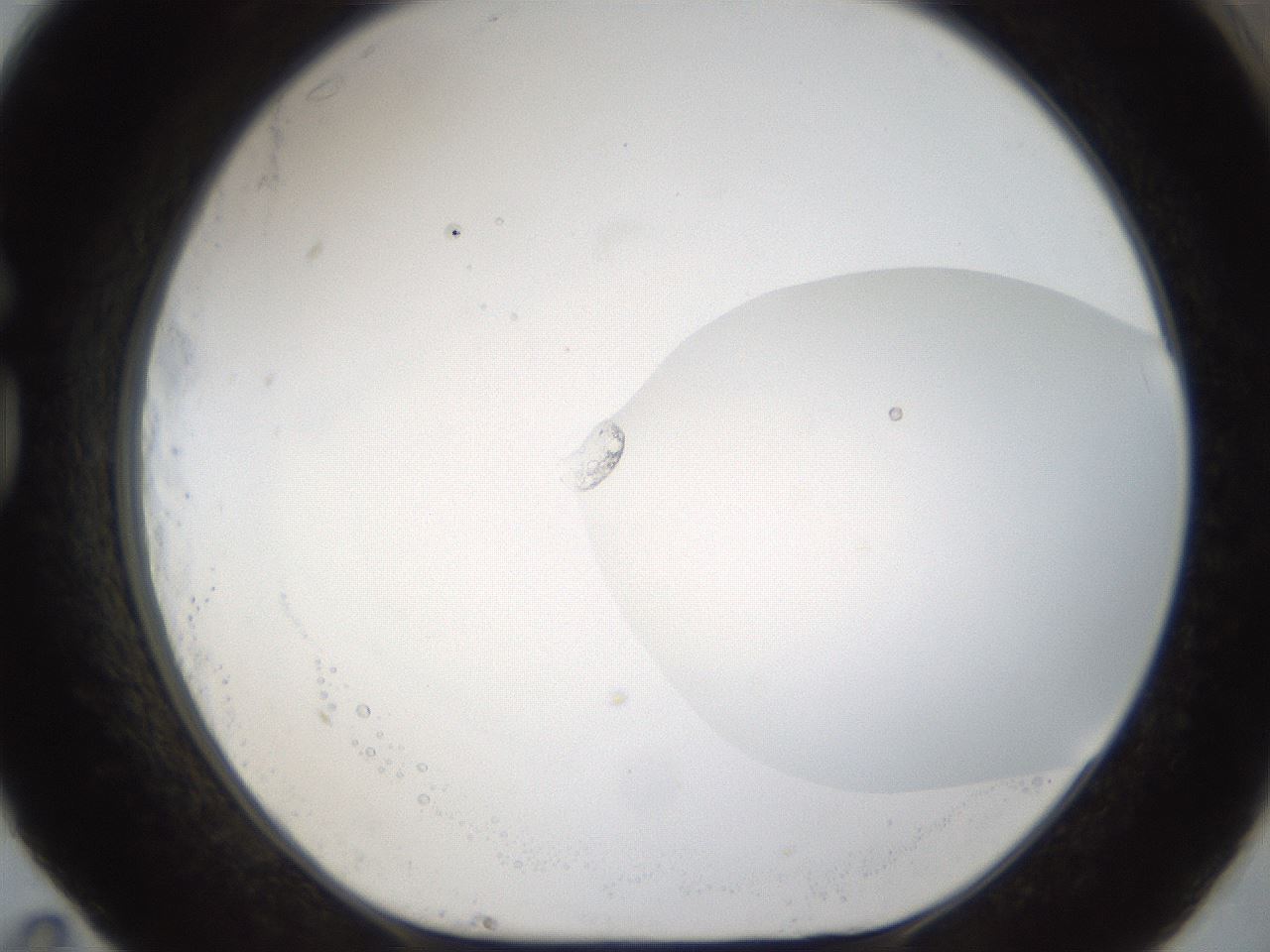 folderID160_plateID1160_batchID3204_wellNum83_profileID1_d1_r62403_ef.jpg