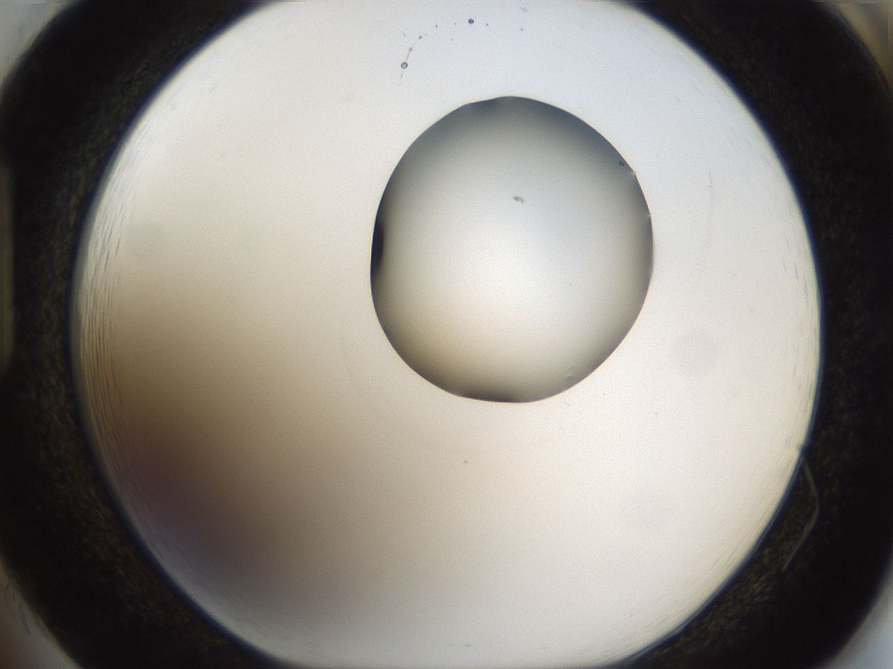 folderID160_plateID1160_batchID3204_wellNum85_profileID1_d1_r62407_ef.jpg