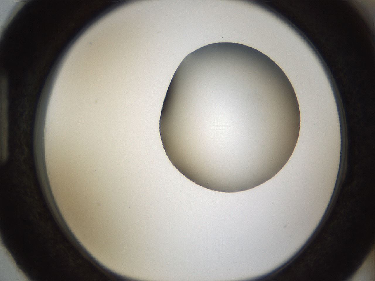 folderID160_plateID1160_batchID3204_wellNum87_profileID1_d1_r62411_ef.jpg