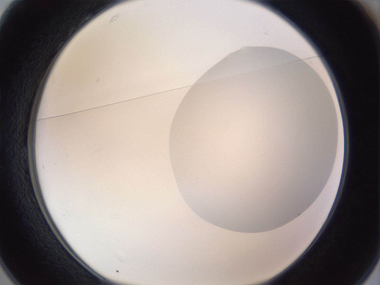 folderID161_plateID1161_batchID3209_wellNum25_profileID1_d1_r63247_ef.jpg
