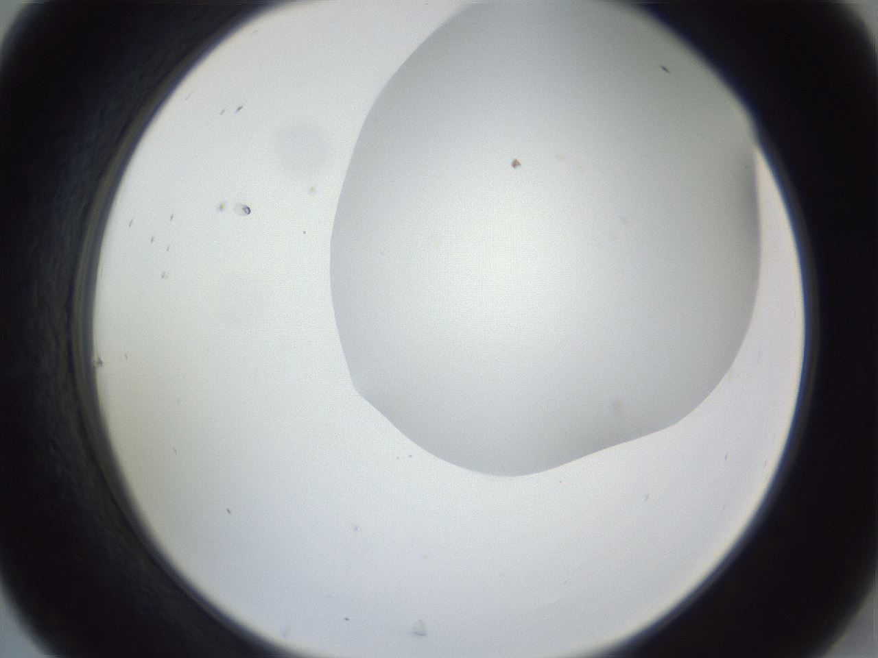 folderID161_plateID1161_batchID3209_wellNum31_profileID1_d2_r63260_ef.jpg