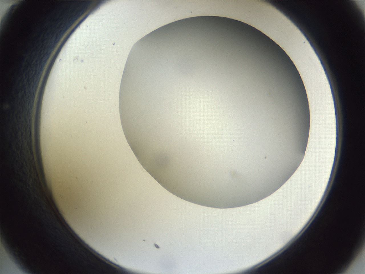folderID161_plateID1161_batchID3209_wellNum35_profileID1_d2_r63268_ef.jpg
