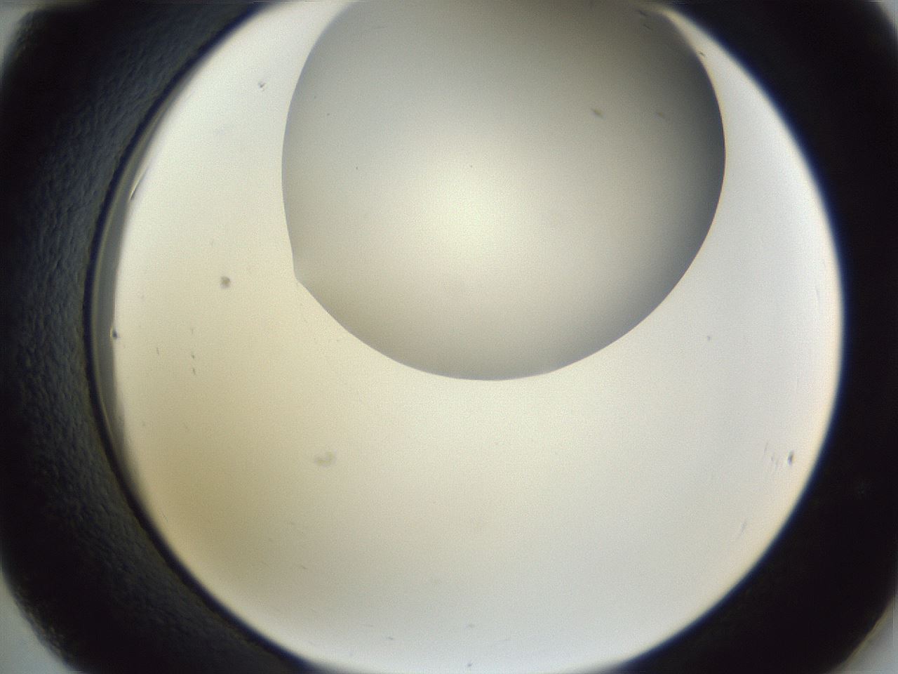 folderID161_plateID1161_batchID3209_wellNum36_profileID1_d2_r63270_ef.jpg