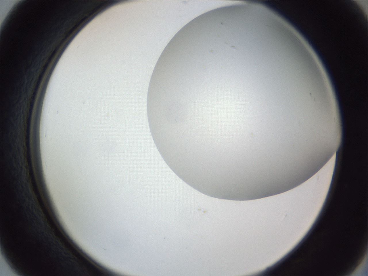 folderID161_plateID1161_batchID3209_wellNum39_profileID1_d2_r63276_ef.jpg