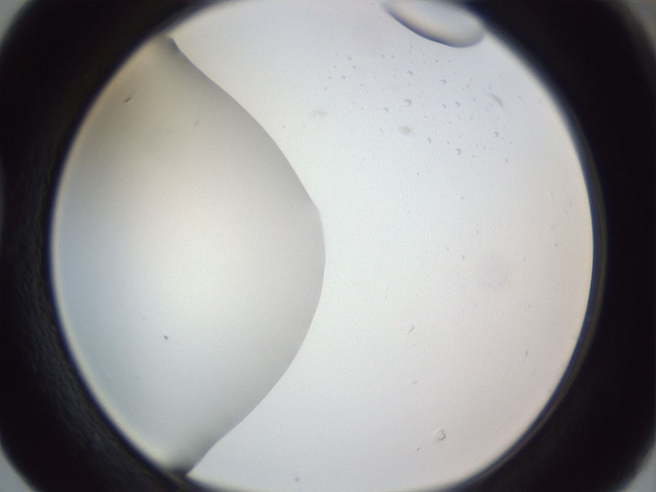 folderID161_plateID1161_batchID3209_wellNum40_profileID1_d1_r63277_ef.jpg