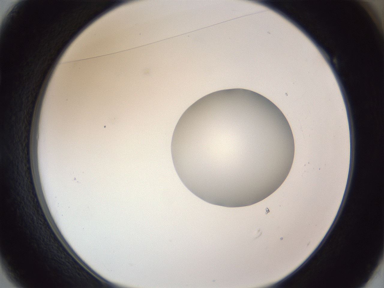 folderID161_plateID1161_batchID3209_wellNum49_profileID1_d1_r63295_ef.jpg