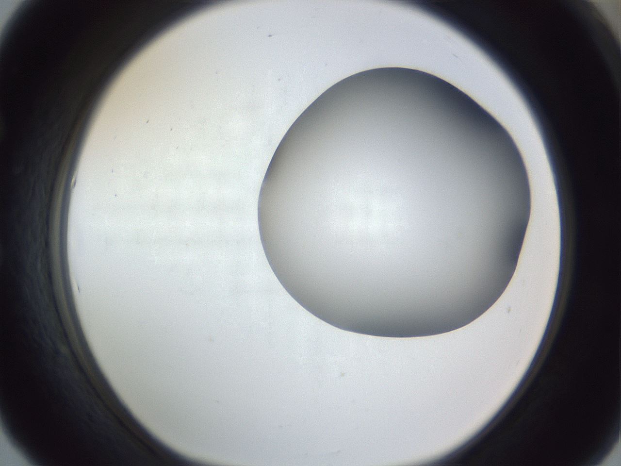 folderID161_plateID1161_batchID3209_wellNum53_profileID1_d1_r63303_ef.jpg