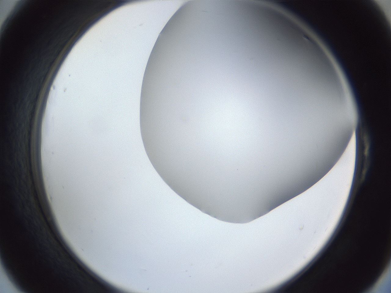folderID161_plateID1161_batchID3209_wellNum54_profileID1_d2_r63306_ef.jpg