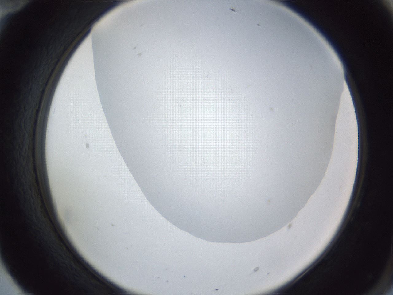 folderID161_plateID1161_batchID3209_wellNum70_profileID1_d2_r63338_ef.jpg