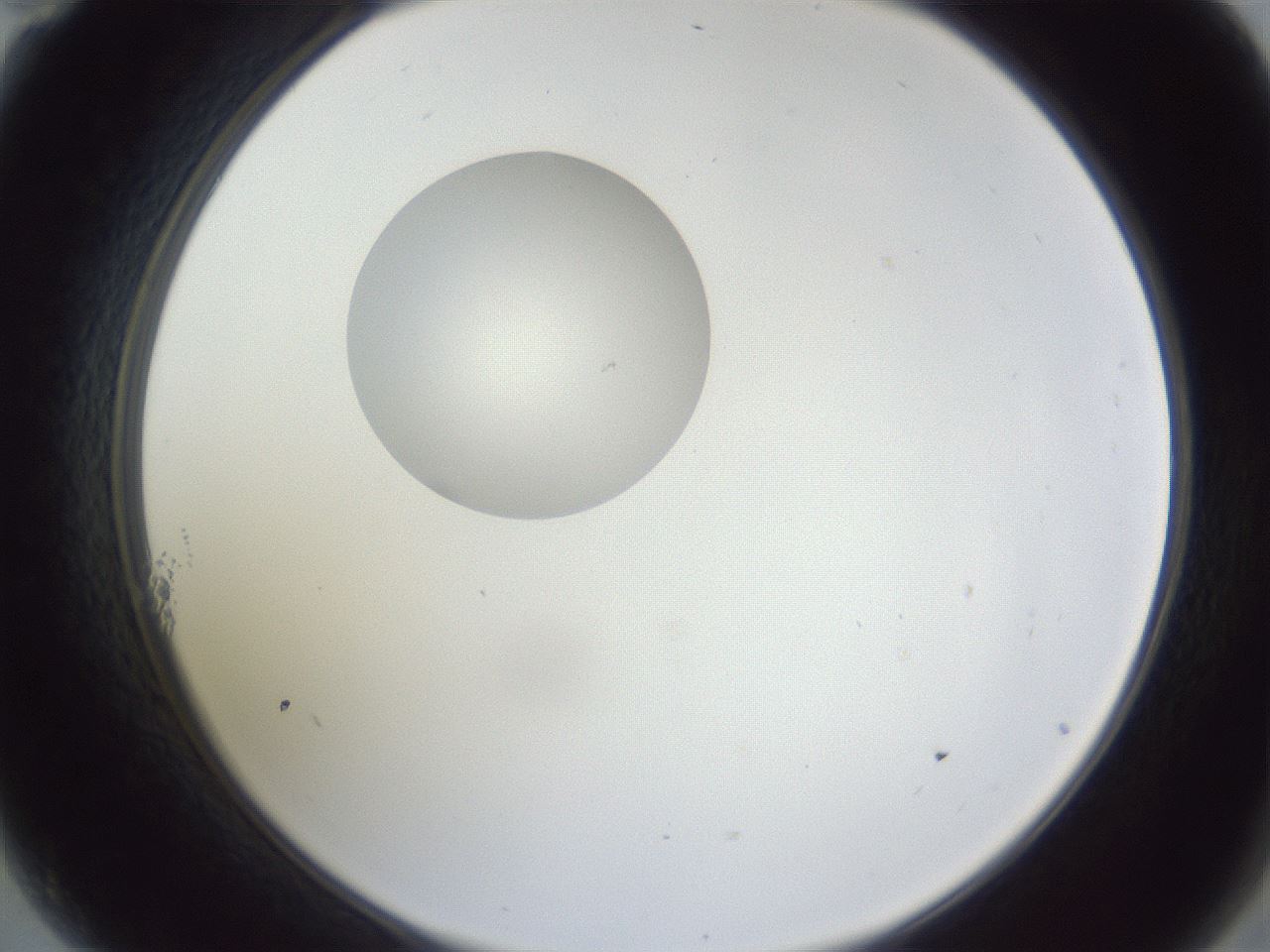 folderID162_plateID1162_batchID3203_wellNum11_profileID1_d2_r62068_ef.jpg