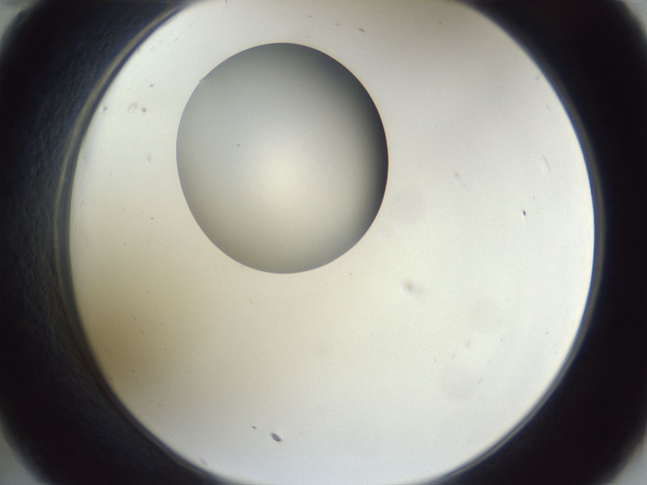 folderID162_plateID1162_batchID3203_wellNum35_profileID1_d2_r62116_ef.jpg