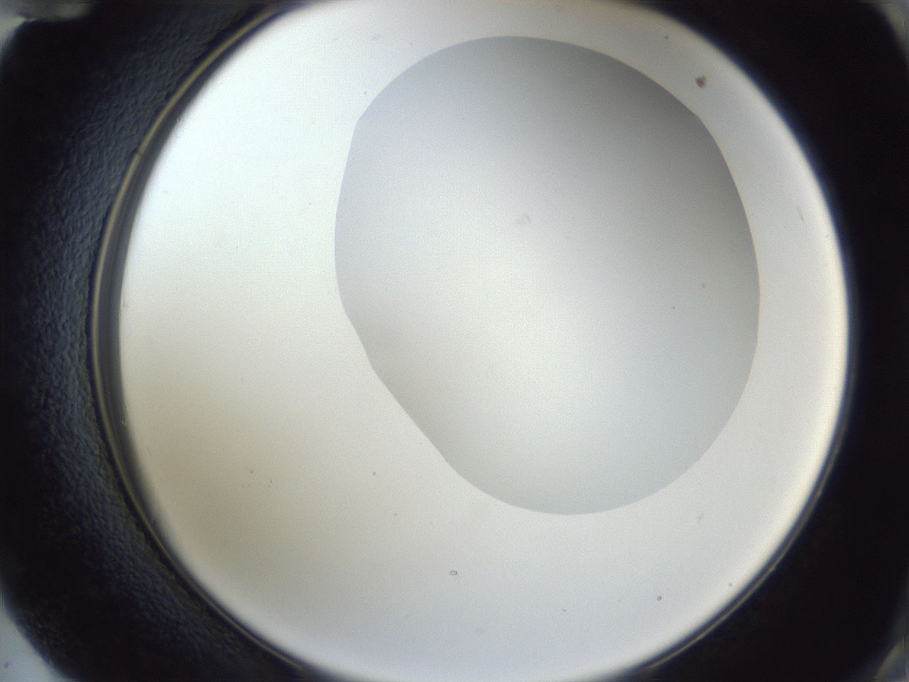 folderID163_plateID1163_batchID3206_wellNum72_profileID1_d2_r62766_ef.jpg