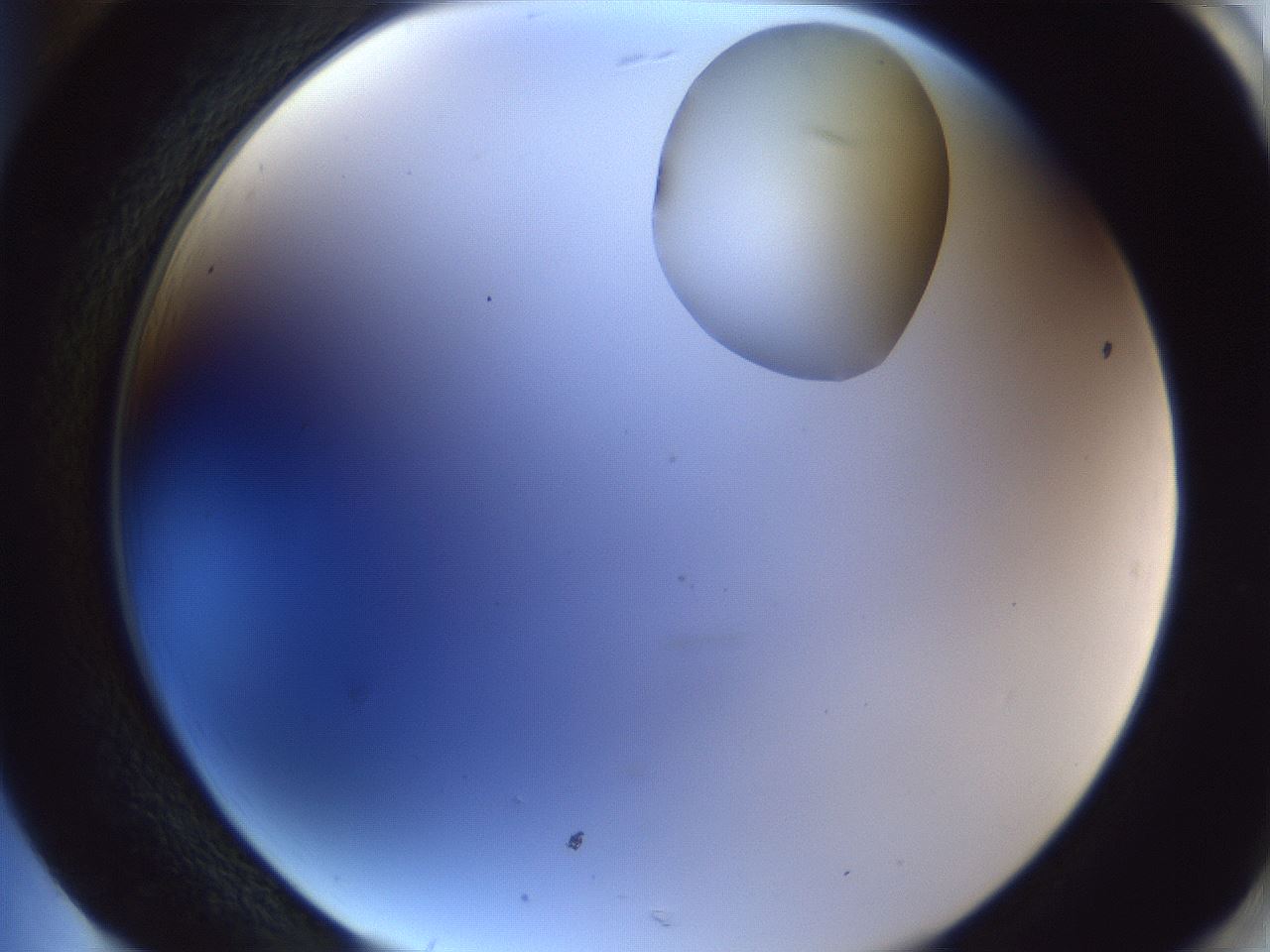 folderID163_plateID1163_batchID3206_wellNum85_profileID1_d2_r62792_ef.jpg