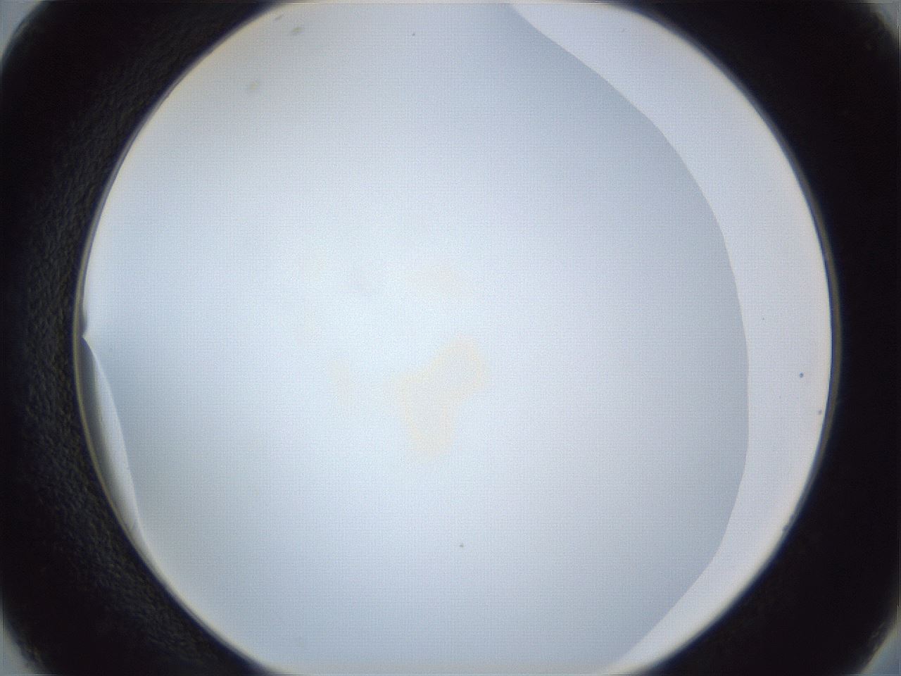 folderID165_plateID1165_batchID3067_wellNum38_profileID1_d2_r61162_ef.jpg