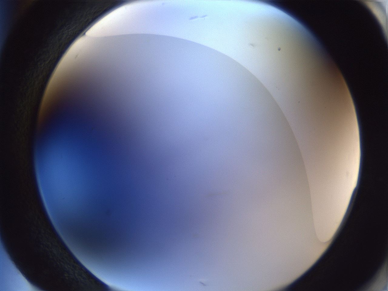 folderID165_plateID1165_batchID3067_wellNum85_profileID1_d2_r61256_ef.jpg