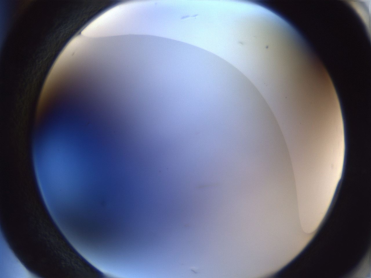 folderID165_plateID1165_batchID3120_wellNum85_profileID1_d2_r61256_ef.jpg