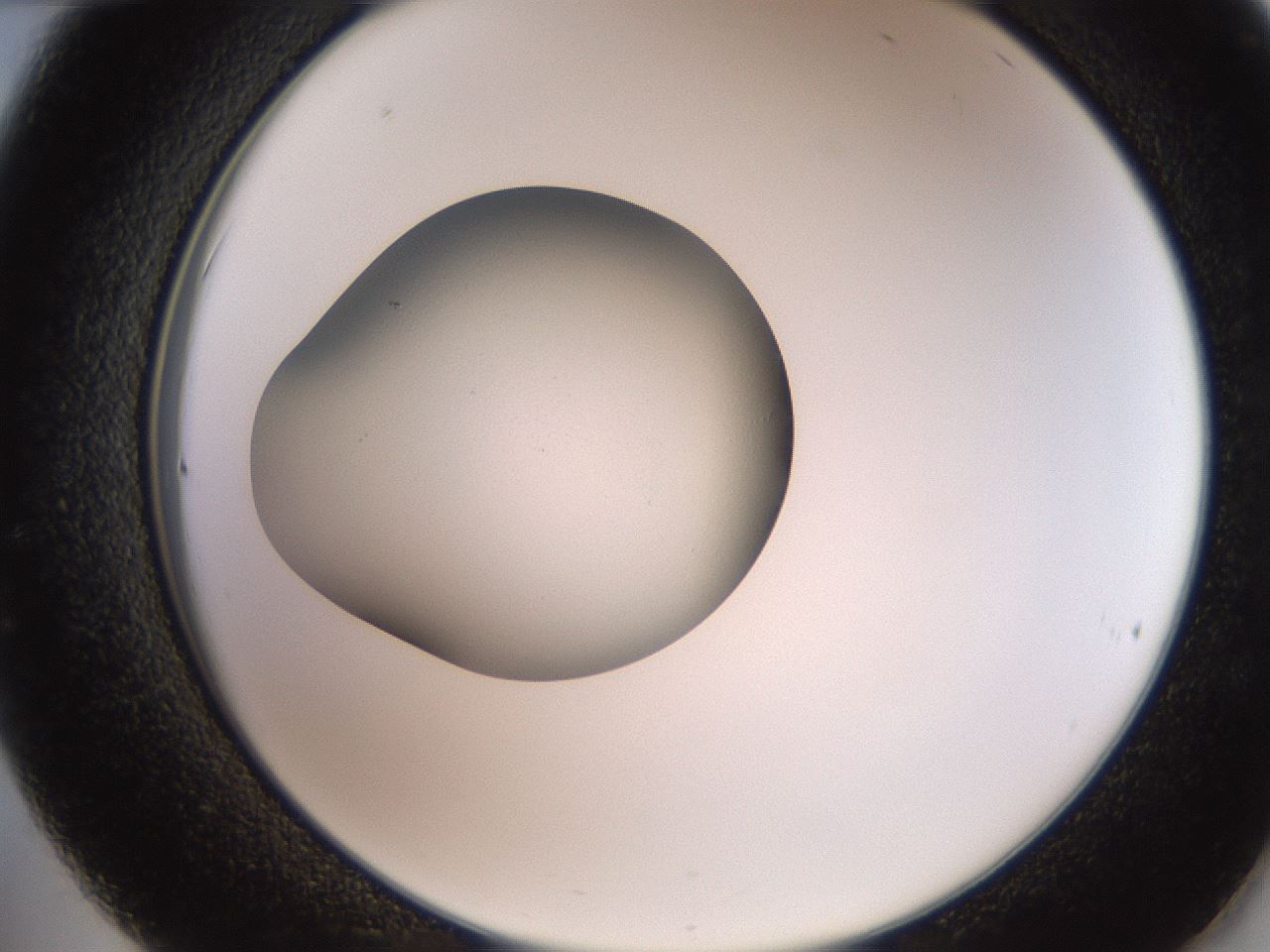 folderID257_plateID2257_batchID10332_wellNum36_profileID1_d2_r156681_ef.jpg