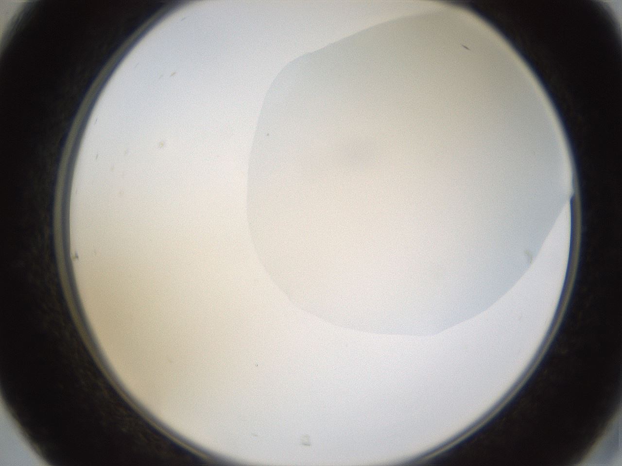 folderID270_plateID1270_batchID4167_wellNum31_profileID1_d2_r73781_ef.jpg