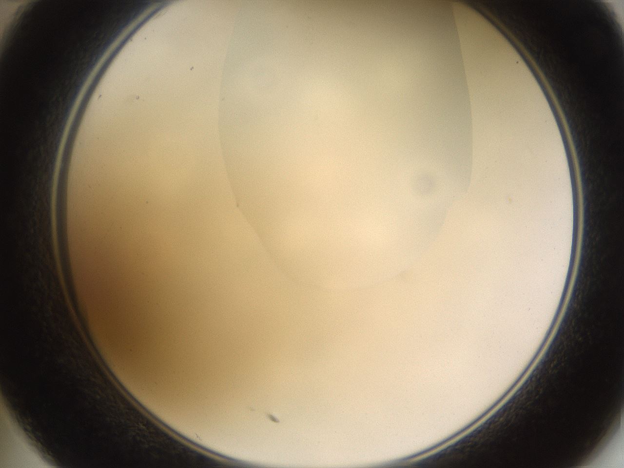 folderID270_plateID1270_batchID4167_wellNum35_profileID1_d2_r73789_ef.jpg