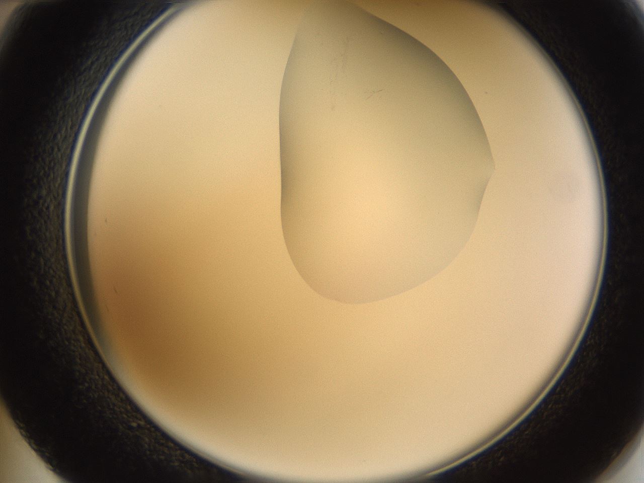 folderID270_plateID1270_batchID4167_wellNum48_profileID1_d2_r73815_ef.jpg