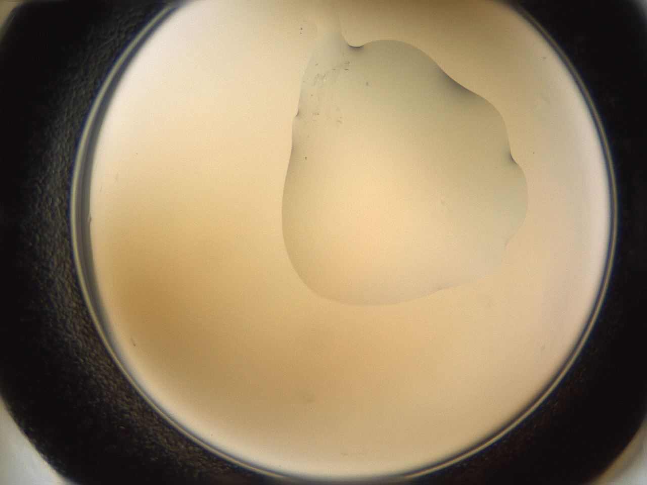 folderID270_plateID1270_batchID4167_wellNum60_profileID1_d2_r73839_ef.jpg