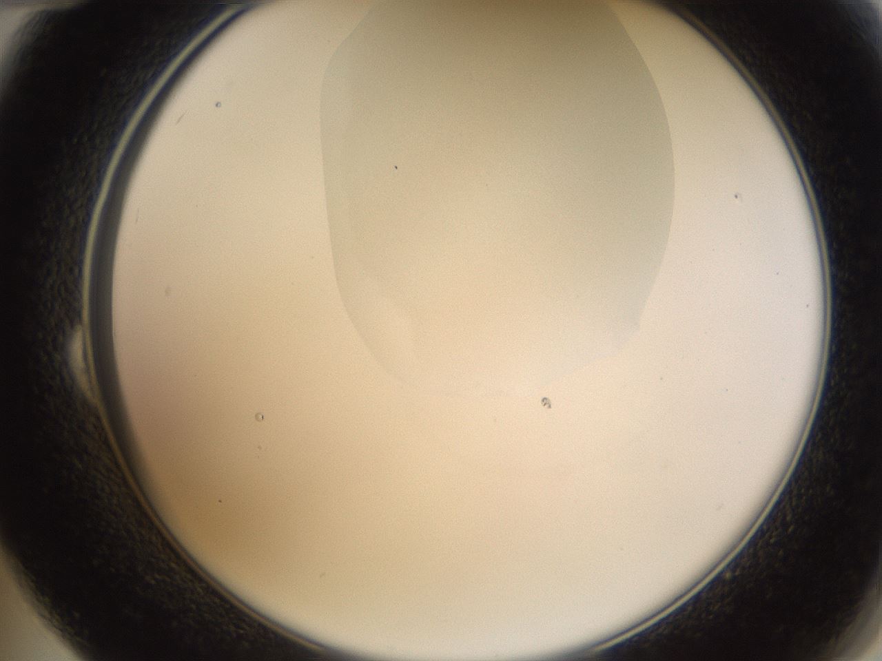 folderID272_plateID1272_batchID4170_wellNum24_profileID1_d2_r74727_ef.jpg