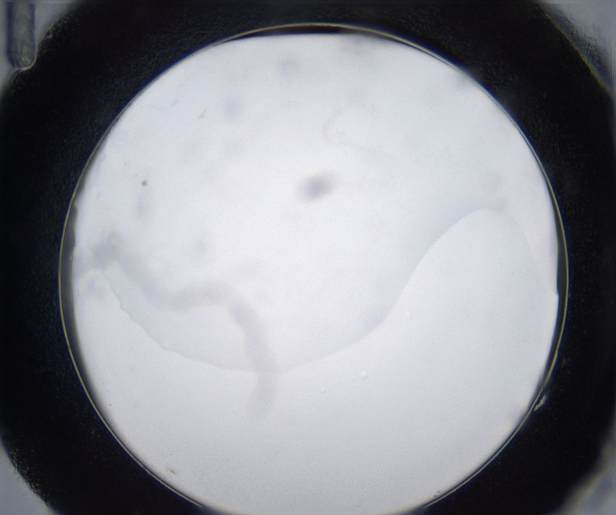 folderID278_plateID2278_batchID10787_wellNum83_profileID1_d2_r158995_ef.jpg