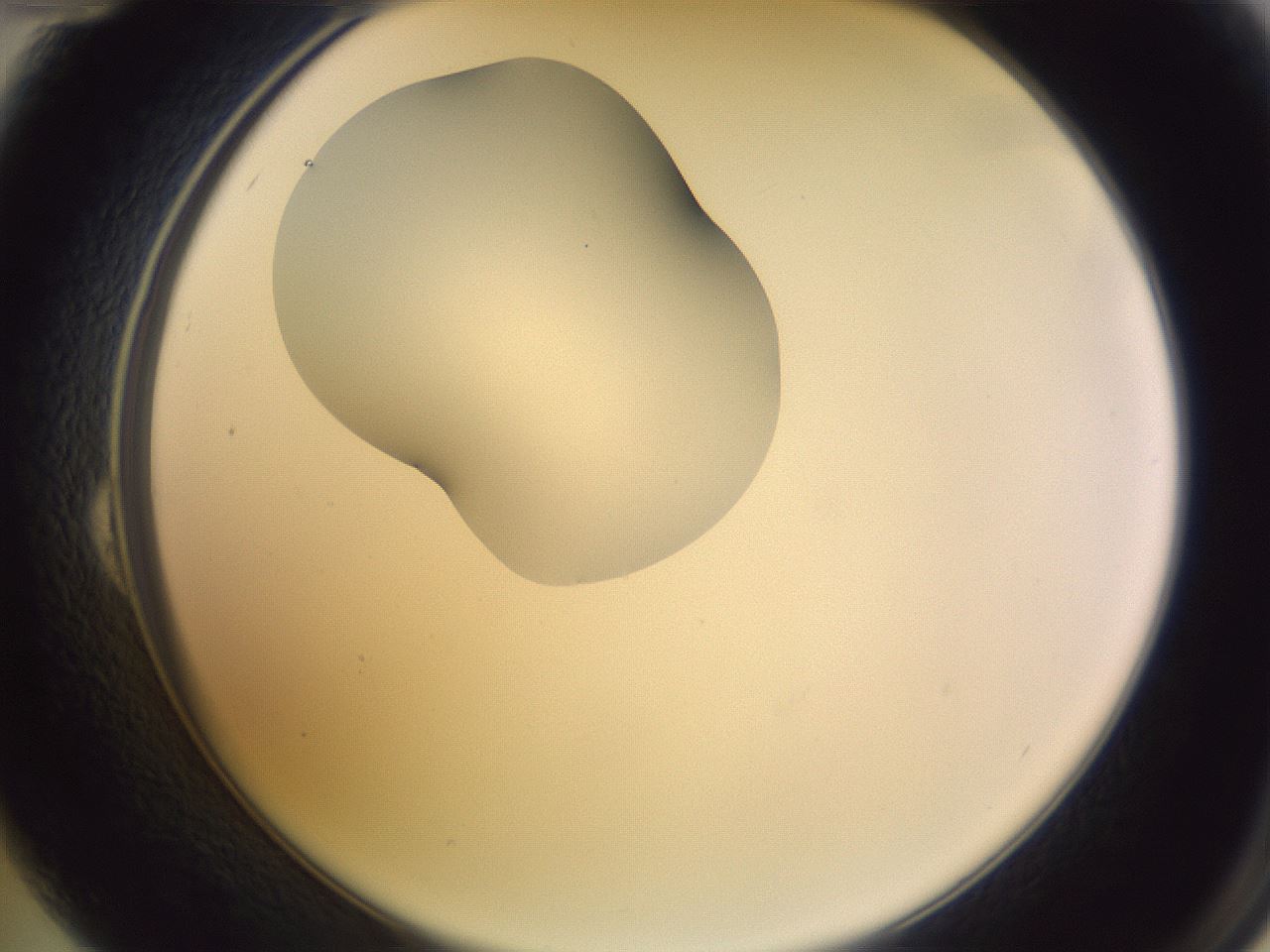 folderID281_plateID1281_batchID4174_wellNum24_profileID1_d2_r75879_ef.jpg