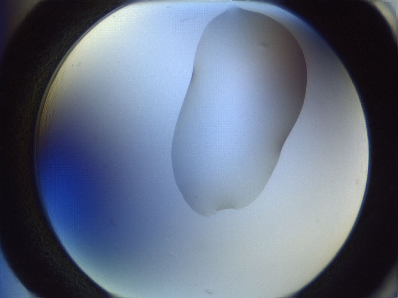 folderID281_plateID1281_batchID4174_wellNum85_profileID1_d2_r76001_ef.jpg